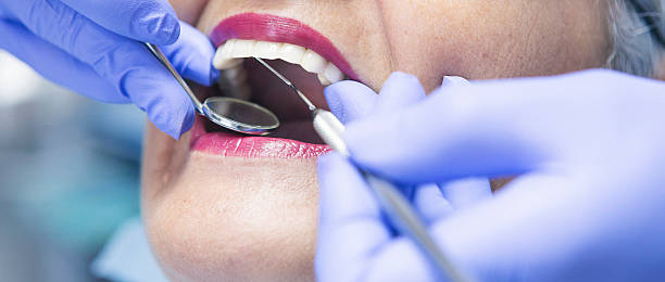 Best Chipped Tooth Repair Near Me  in Banks Springs, LA